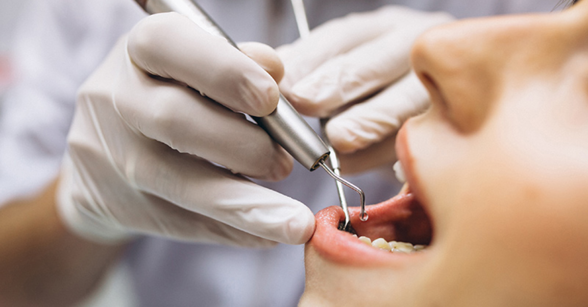 Common Dental Problems and Their Solutions: A Guide by Experts in Noida