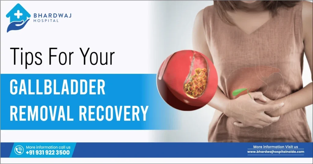 Tips for Your Gallbladder Removal Recovery