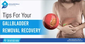 Tips for Your Gallbladder Removal Recovery