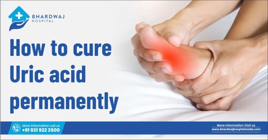 How To Cure Uric Acid Permanently