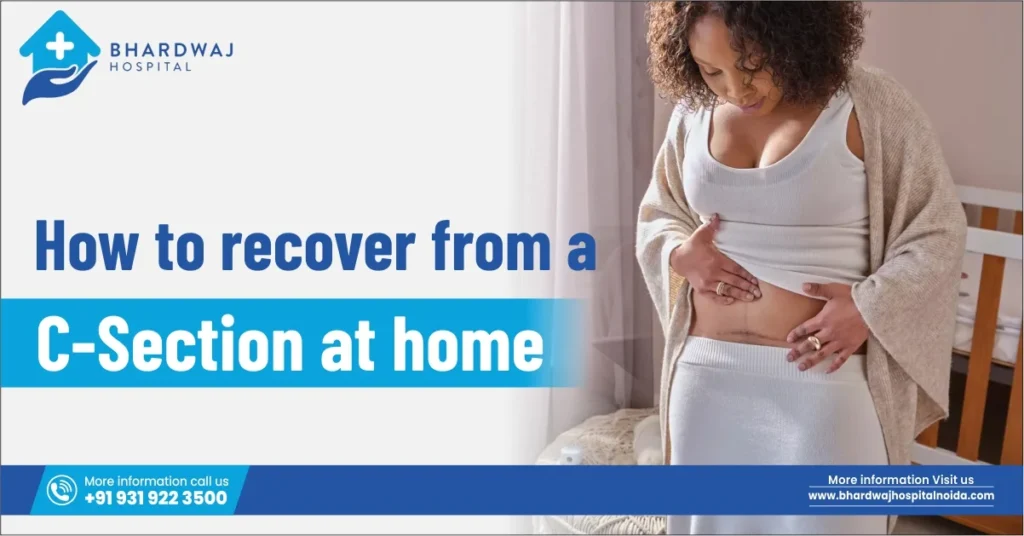 how to recover from a C-section