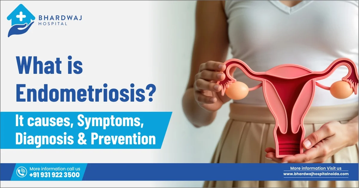 What is endometriosis?