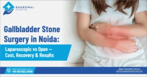 Gallbladder Surgery in Noida